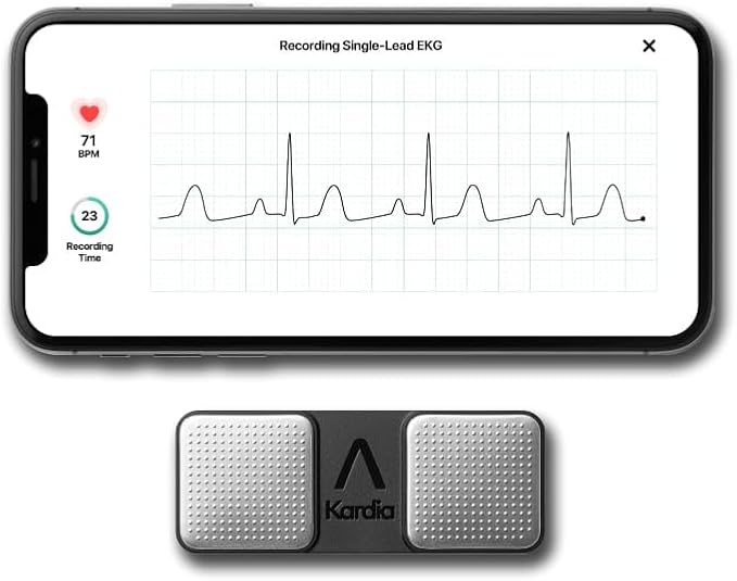 KardiaMobile 1-Lead Personal EKG Monitor – Record at Home – Detects AFib & Irregular Arrhythmias – Easy Results in 30 Seconds – Works w/Most Smartphones