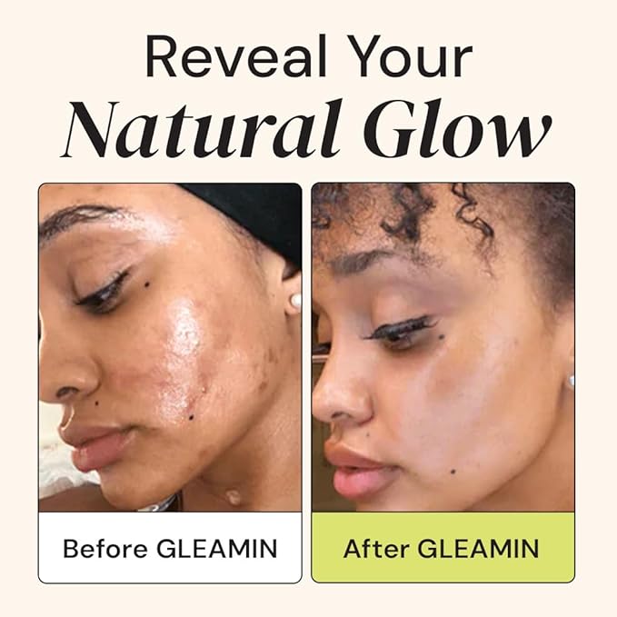 Gleamin Advanced Brightening Face Moisturizer - Face Cream for Women & Men with Vitamin C, Ceramides, Turmeric & Hyaluronic Acid - Faded Cream for Dark Spots, Uneven Skin Tone & Hydration - 1.7 fl oz