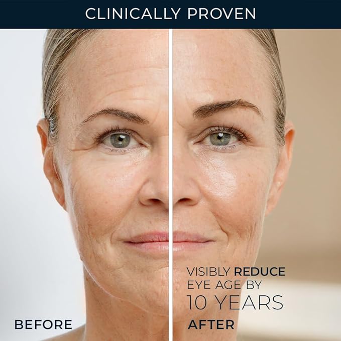 RoC Retinol Correxion Under Eye Cream for Dark Circles & Puffiness, Daily Wrinkle Cream, Anti Aging Line Smoothing Skin Care Treatment for Women and Men, 0.5 oz (Packaging May Vary)