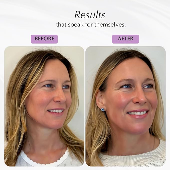 Balm Set – Grapefruit Glacé & Bergamot Beurre (2.5 oz x 2)