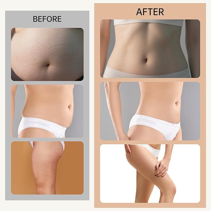 Azhien 3-in-1 Body Sculptor,Body Sculpting Massager for Stomach,Waist,Belly, Arms,Legs,Thighs,Back Massage Tool,Body Exercise Machine,Skin Tightening Device