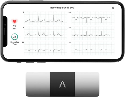 KardiaMobile 6-Lead Personal EKG Monitor – Six Views of The Heart – Detects AFib and Irregular Arrhythmias – Instant Results in 30 Seconds – Works with Most Smartphones