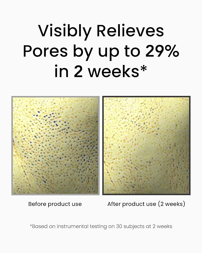 Korean DOMINAS Retinol Serum for Face (1fl oz) – Youth Rejuvenating Face Ampoule for Improving Fine Lines & Reducing Pigmentation, Skin Care for Day & Night Use. Vitamin C, Niacinamide, Peptide