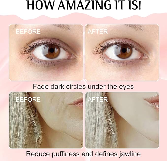 Gua Sha Facial Tools and Face Roller Set, Lymphatic Drainage Massager，Stainless Steel Facial Sculpting Eyes Roller Guasha for Face, Chin & Jawline Sculpting,Skin Care